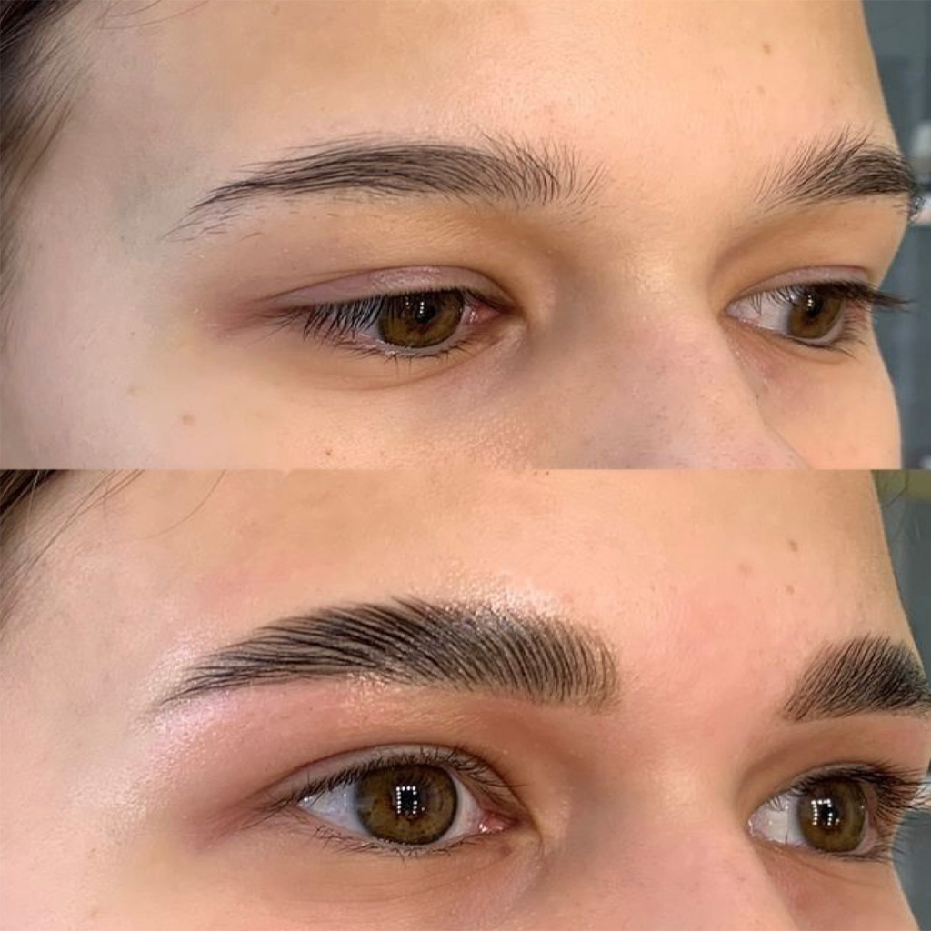 Epileren met touw & wax 5 lift01